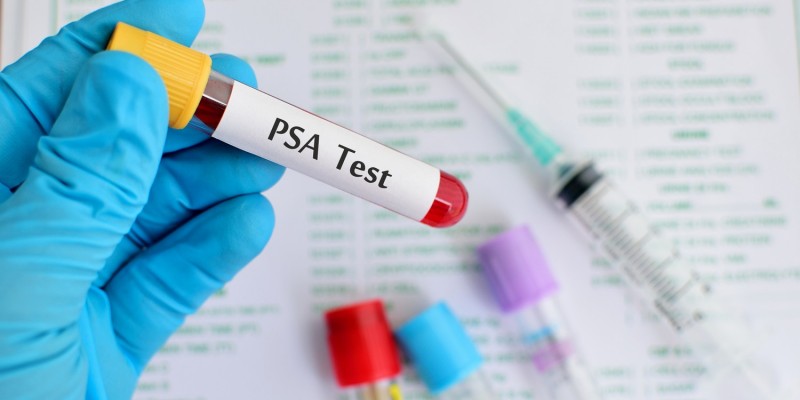 Ein PSA-Test kann Aufschluss über ein Prostatakarzinom geben