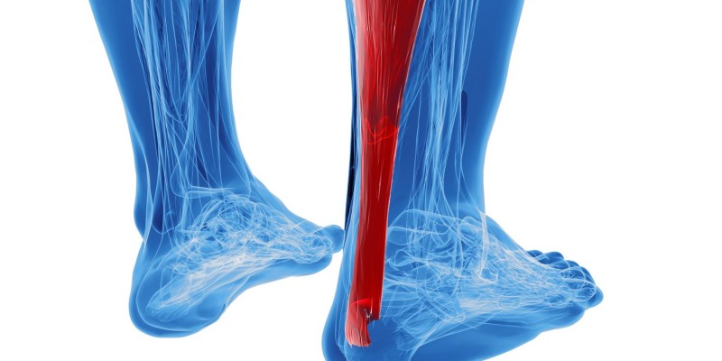 3-D-Grafik einer Achillessehne am rechten Bein