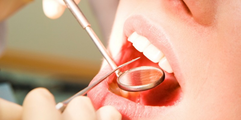 Karies ist für den Zahnarzt leicht festzustellen
