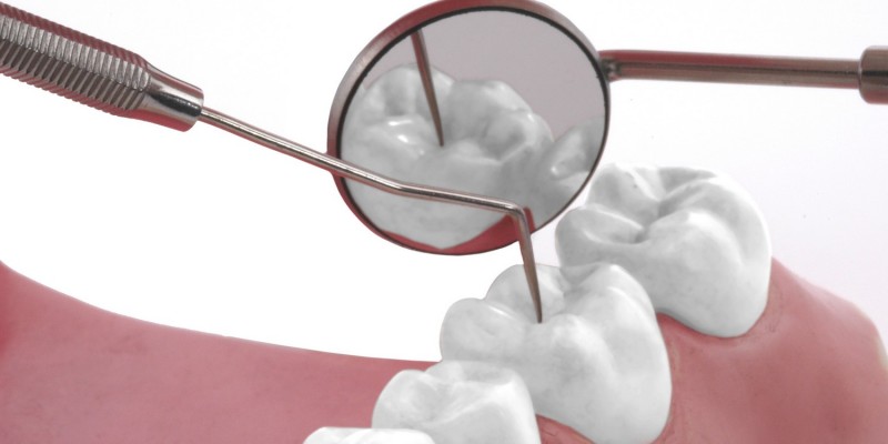 Die Zahnsubstanz ist von Mensch zu Mensch unterschiedlich stark kariesgefährdet