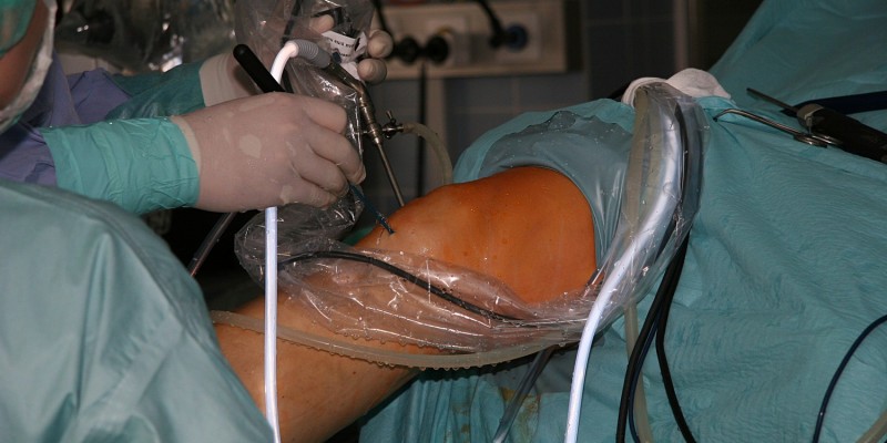 Operation mit Arthroskopie des Knies