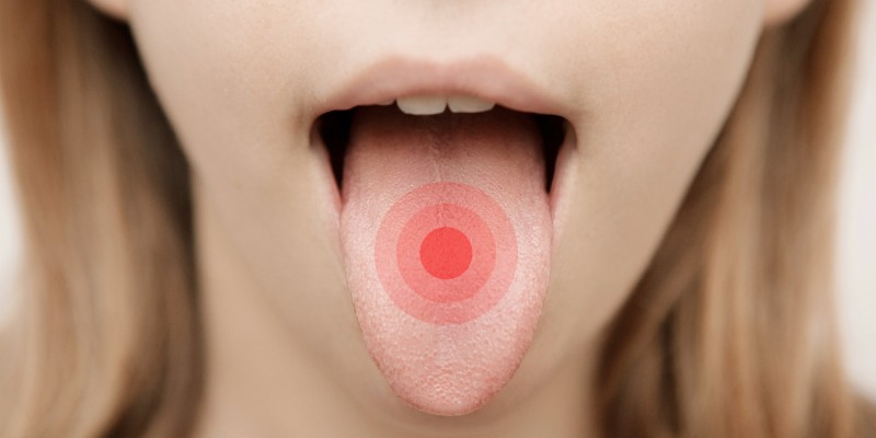Die Zunge kann unterschiedliche Farben annehmen