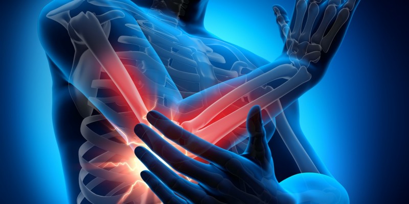 Oft ist eine Überbeanspruchung die Ursache für Armschmerzen