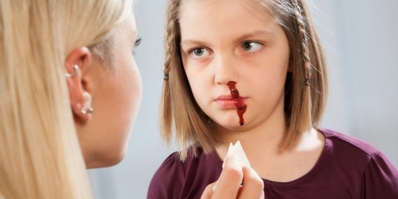 Kinder haben relativ häufig Nasenbluten